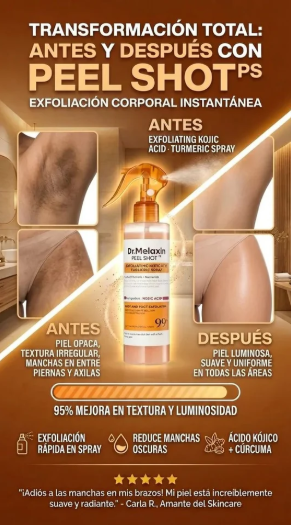 Spray Exfoliante de Ácido Kójico y Cúrcuma | Exfoliante Corporal Despigmentante